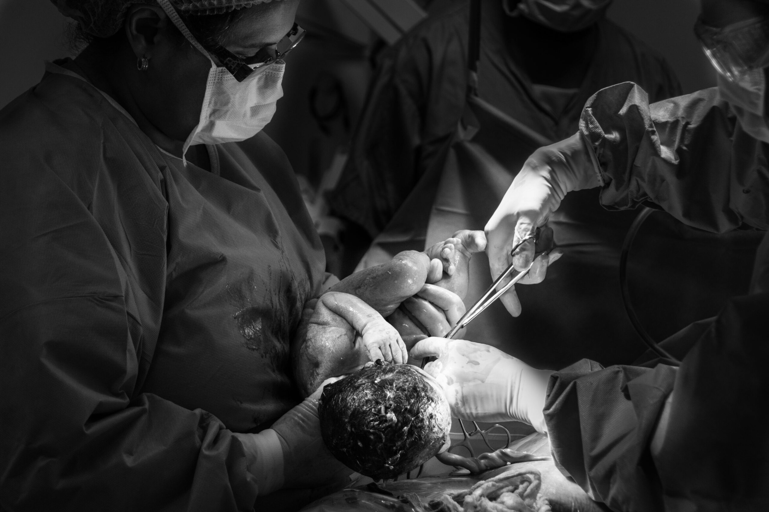 Black and white photo of a newborn delivery in a hospital operating room.